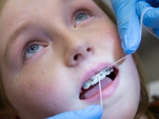 Girl at the orthodontist changing her wires